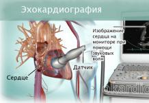 Ecocardiografia del cuore: l'essenza del metodo, i suoi benefici, come funziona la procedura